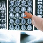 6 Ways Bernhard Scheja Combines Internal Medicine and Imaging